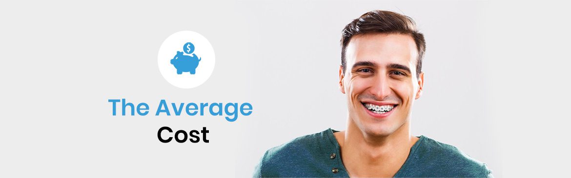 How Much Does Invisalign Cost Without Insurance? - GoodRx