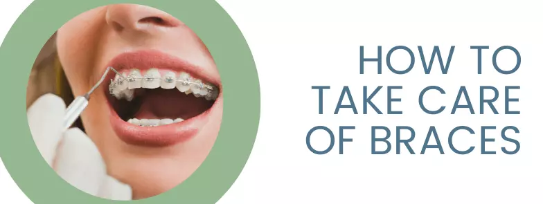 How to Take Care of Braces | WI Orthodontist | Bubon Orthodontist